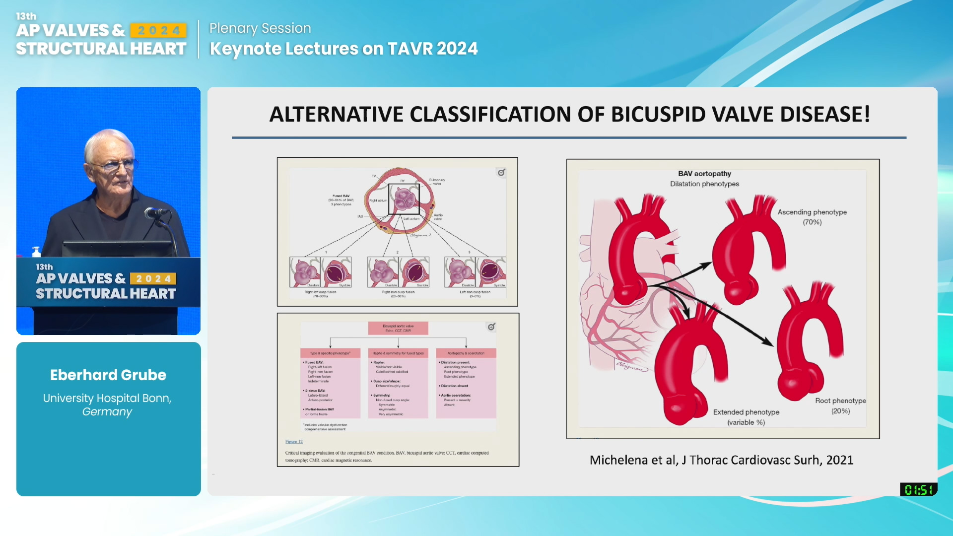 Keynote Lectures on TAVR 2024