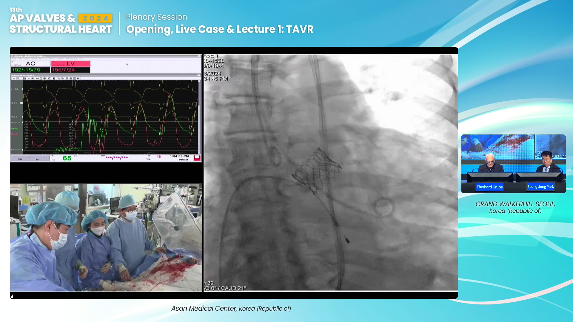 Opening, Live Case & Lecture 1: TAVR