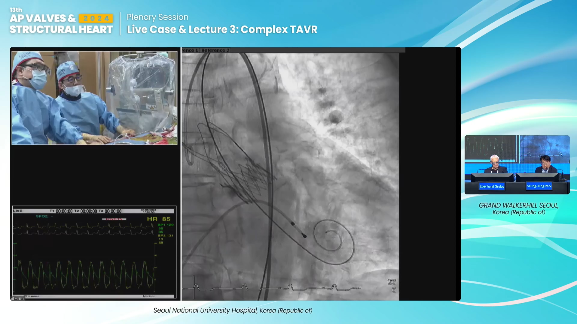 Live Case & Lecture 3: Complex TAVR